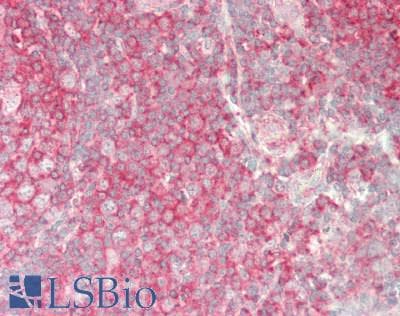 IHC-plus™ E6AP / UBE3A Antibody (aa342-585)