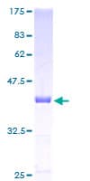 Human CDA / Cytidine Deaminase Protein (Recombinant GST)