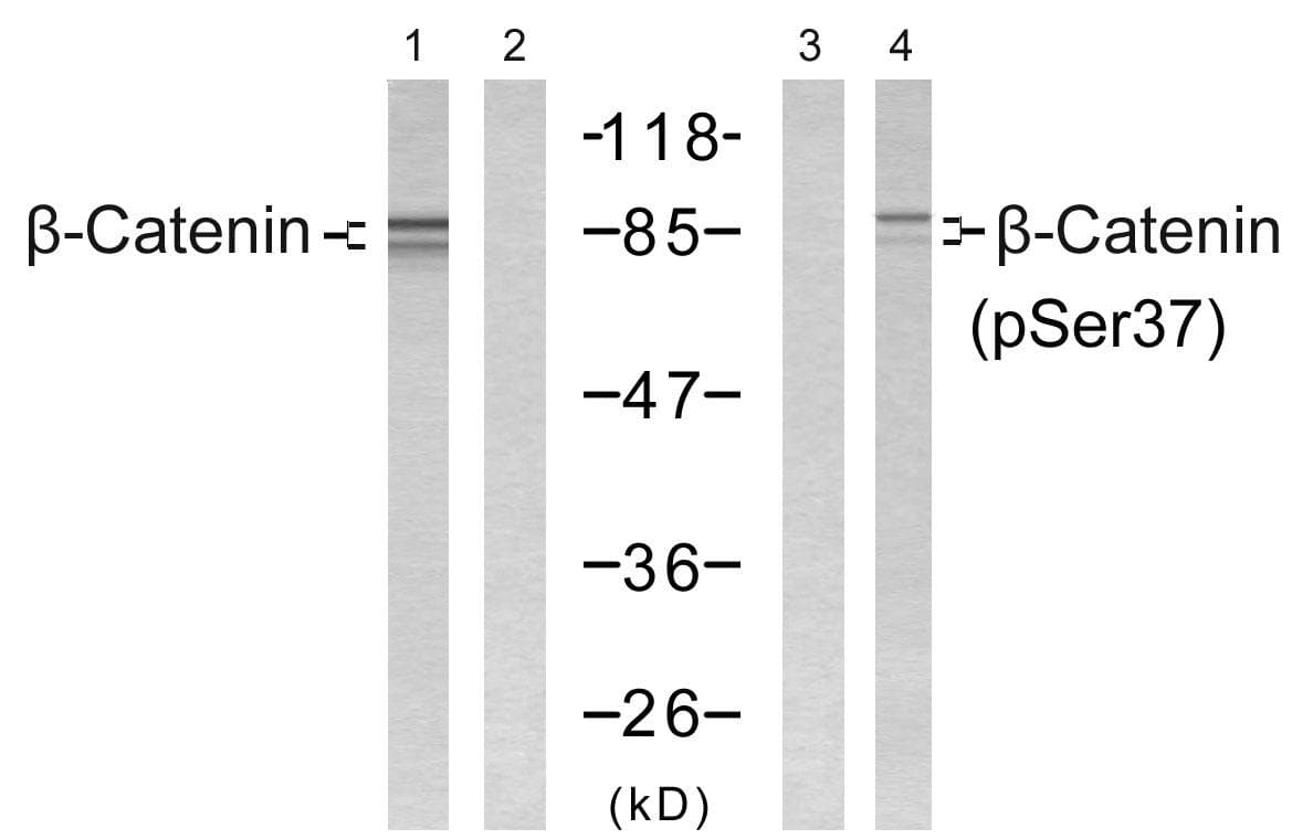 CTNNB1 / Beta Catenin Antibody (phospho-Ser62)