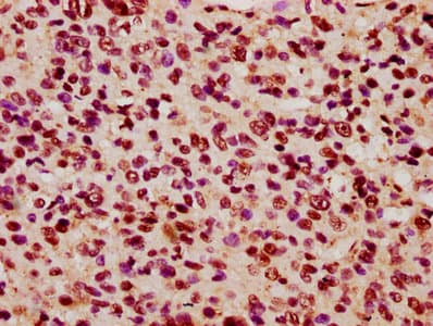 KIF3C Antibody