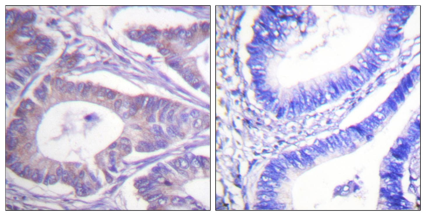 Vimentin Antibody