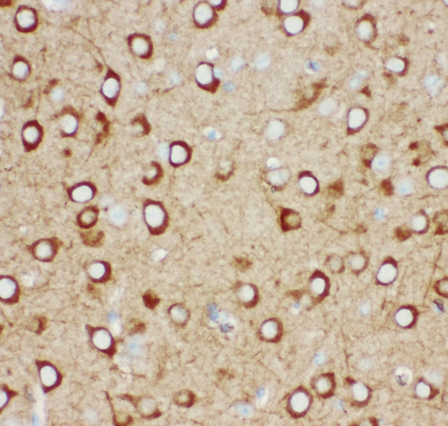 Polyclonal Rabbit anti-Human ITPR1 / IP3 Receptor Type 1 Antibody (aa2411-2758, IHC, WB)