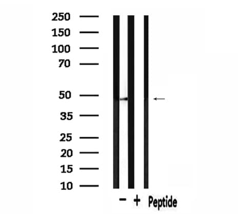 PRKAR2A Antibody