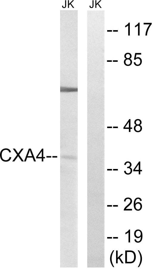 GJA4 / CX37 / Connexin 37 Antibody