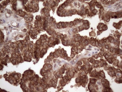CSF2RB / CD131 Antibody (clone OTI4H3)