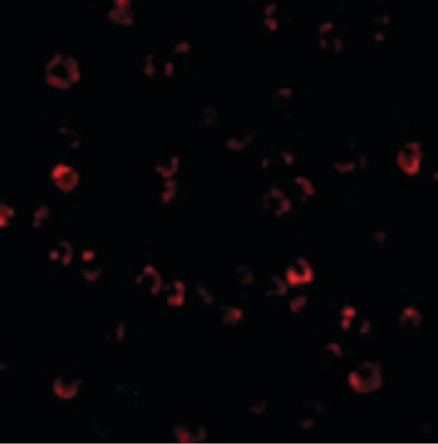 ANTXR1 / TEM8 Antibody