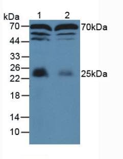 MBP / Myelin Basic Protein Antibody (aa18-222)