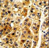 Polyclonal Rabbit anti-Human NFKBIA / IKB Alpha / IKBA Antibody (aa12-41, IHC, IF, WB)