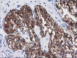 ATP6V1B1 Antibody (clone OTI3B11)