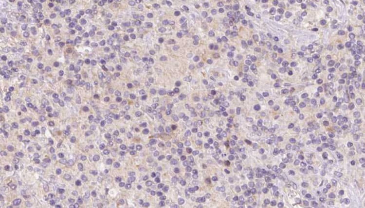 Polyclonal Rabbit anti-Human HBXIP Antibody (IHC, WB)