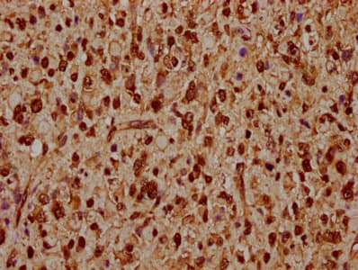 Polyclonal Rabbit anti-Human HIST1H1C Antibody (IHC)