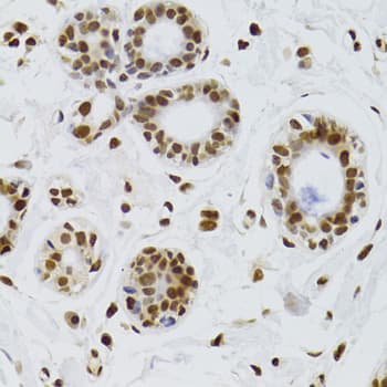 Polyclonal Rabbit anti-Human XRCC6 / Ku70 Antibody (IHC, IF, WB)