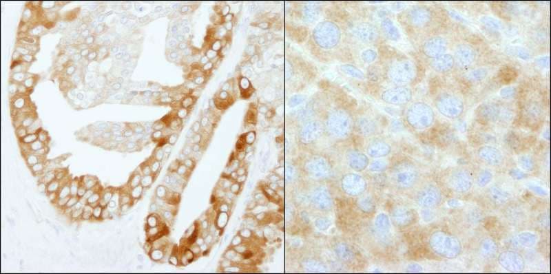 FASN / Fatty Acid Synthase Antibody (aa2462-2511)