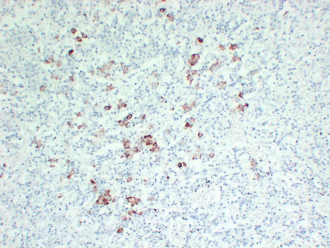 TSHB / TSH-Beta Antibody (clone ABT-TSH)