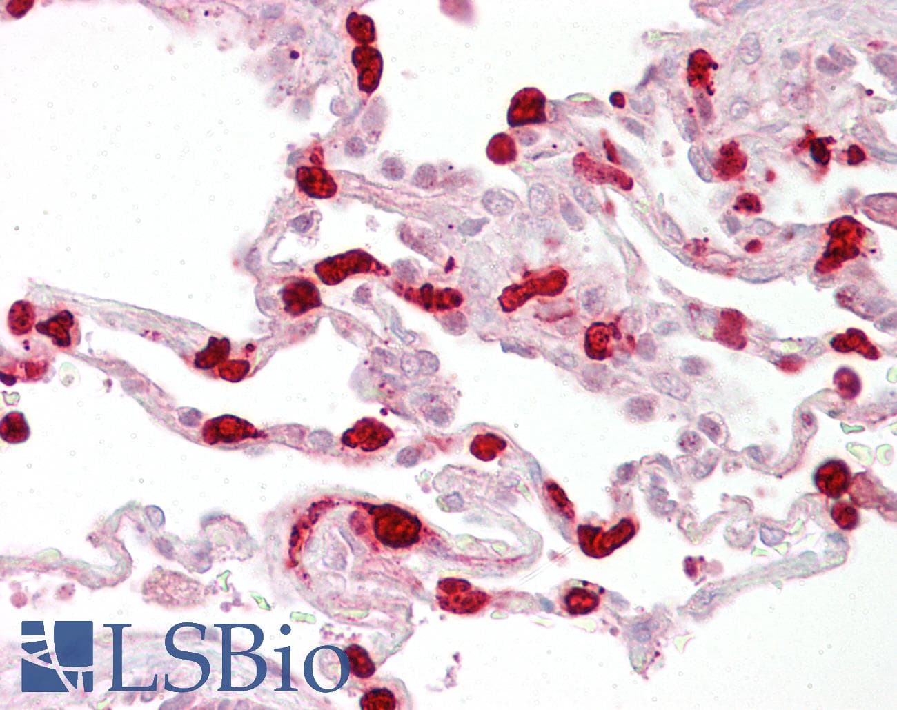 GSTT1 Antibody (C-Terminus)