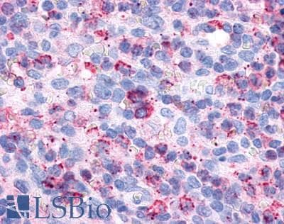 PathPlus™ Polyclonal Rabbit anti-Human P2RY6 / P2Y6 Antibody (Cytoplasmic Domain, IHC)