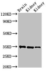 Polyclonal Rabbit anti-Human RPLP0 Antibody (aa1-317)