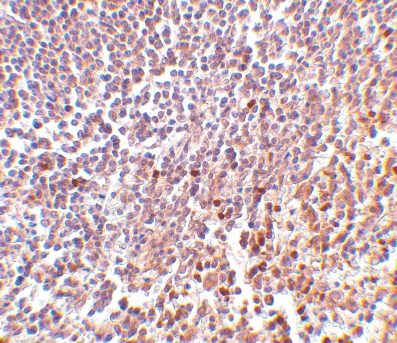 MD-1 / LY86 Antibody