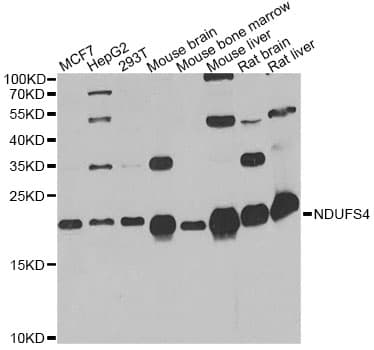 Polyclonal Rabbit anti-Human NDUFS4 Antibody (IF, WB)