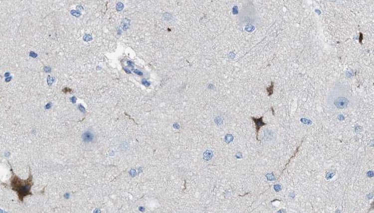 IGSF4C / CADM4 Antibody
