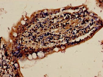 Polyclonal Rabbit anti-Human FBXW7 / FBW7 Antibody (IHC)