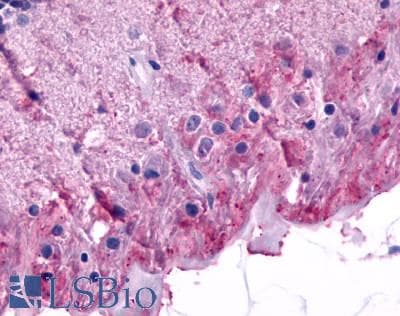 PathPlus™ GRM6 / MGLUR6 Antibody (N-Terminus)