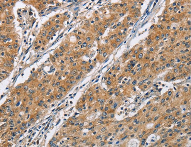 Polyclonal Rabbit anti-Human COPB1 / Beta-COP Antibody (IHC, WB)