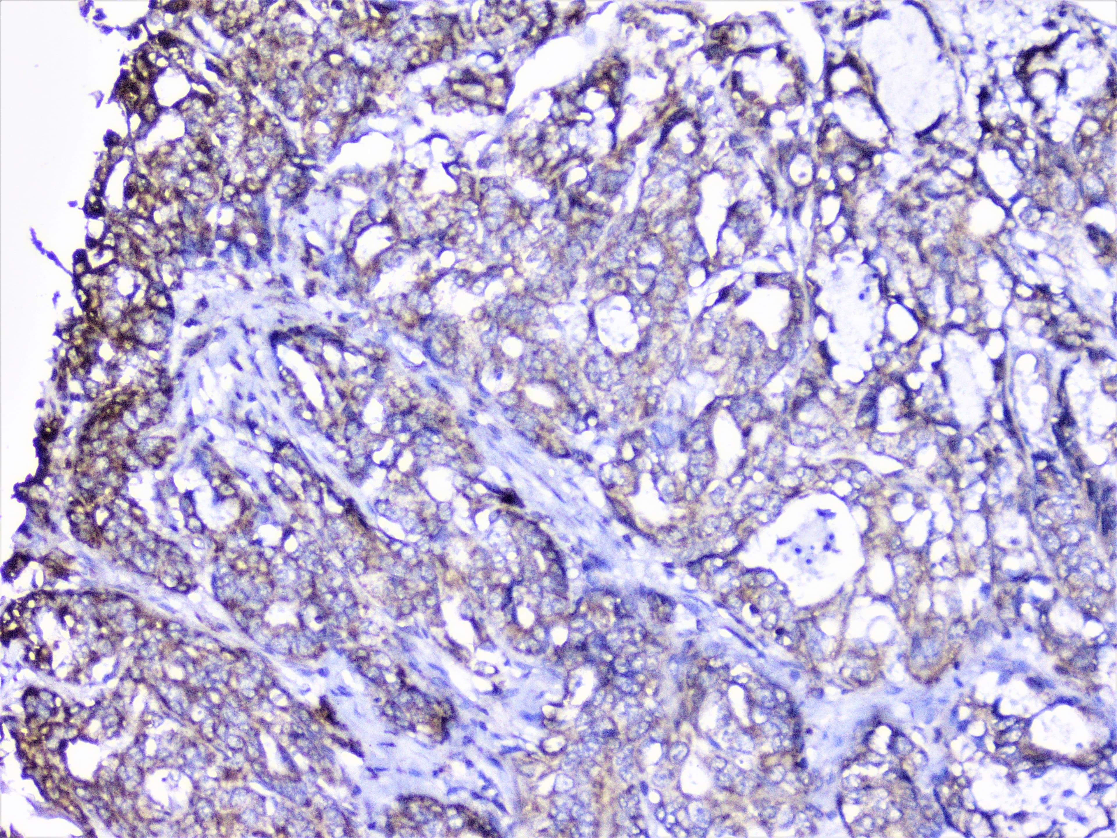 CTTN / Cortactin Antibody