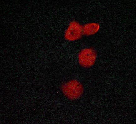 RPS6KA5 / MSK1 Antibody