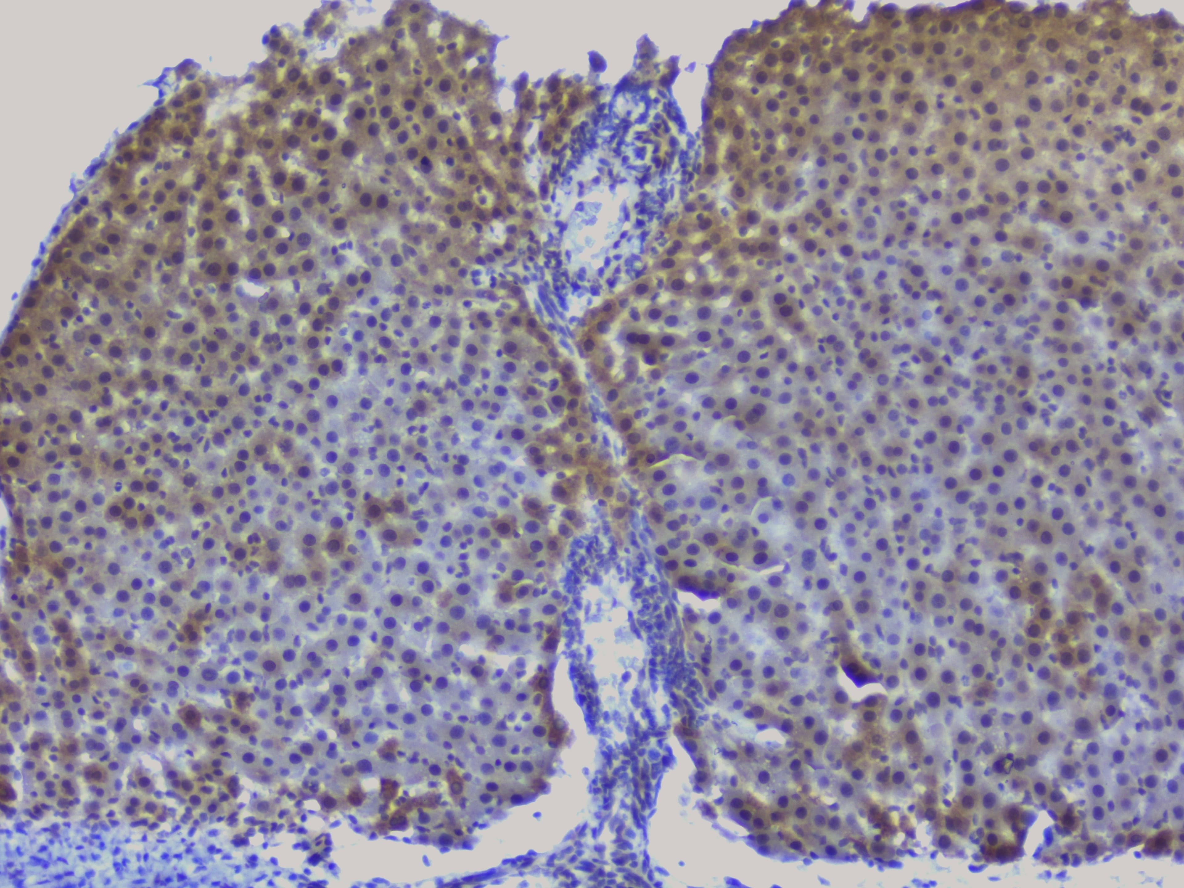 NRF1 / NRF-1 Antibody