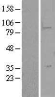 LYPD5 Protein (Over-Expression Lysate Myc-DDK (Flag))