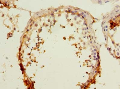 RAPGEF5 / GFR Antibody