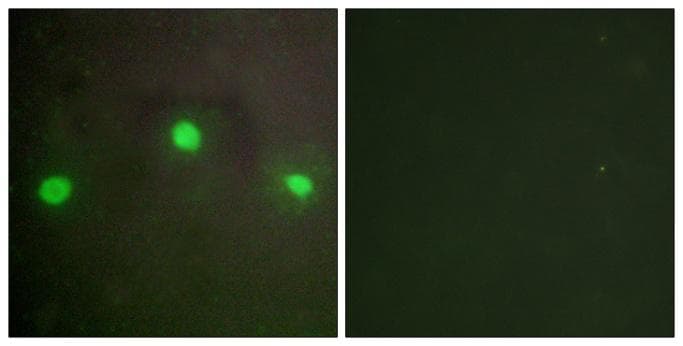 ATRX Antibody
