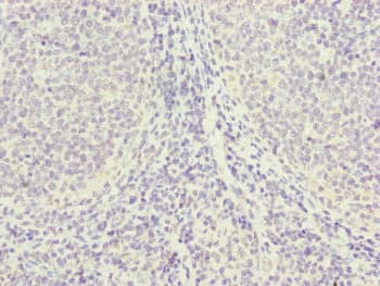 PGLS / 6PGL Antibody