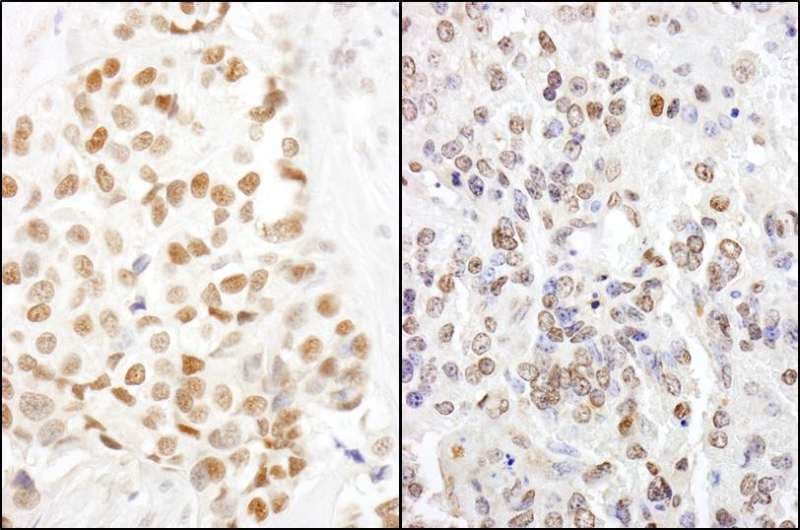 Polyclonal Rabbit anti-Human HMGN1 / HMG14 Antibody (aa90-100, IHC, IF, WB)