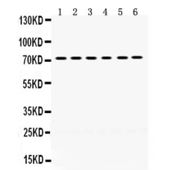 LIMK2 Antibody (aa596-635)