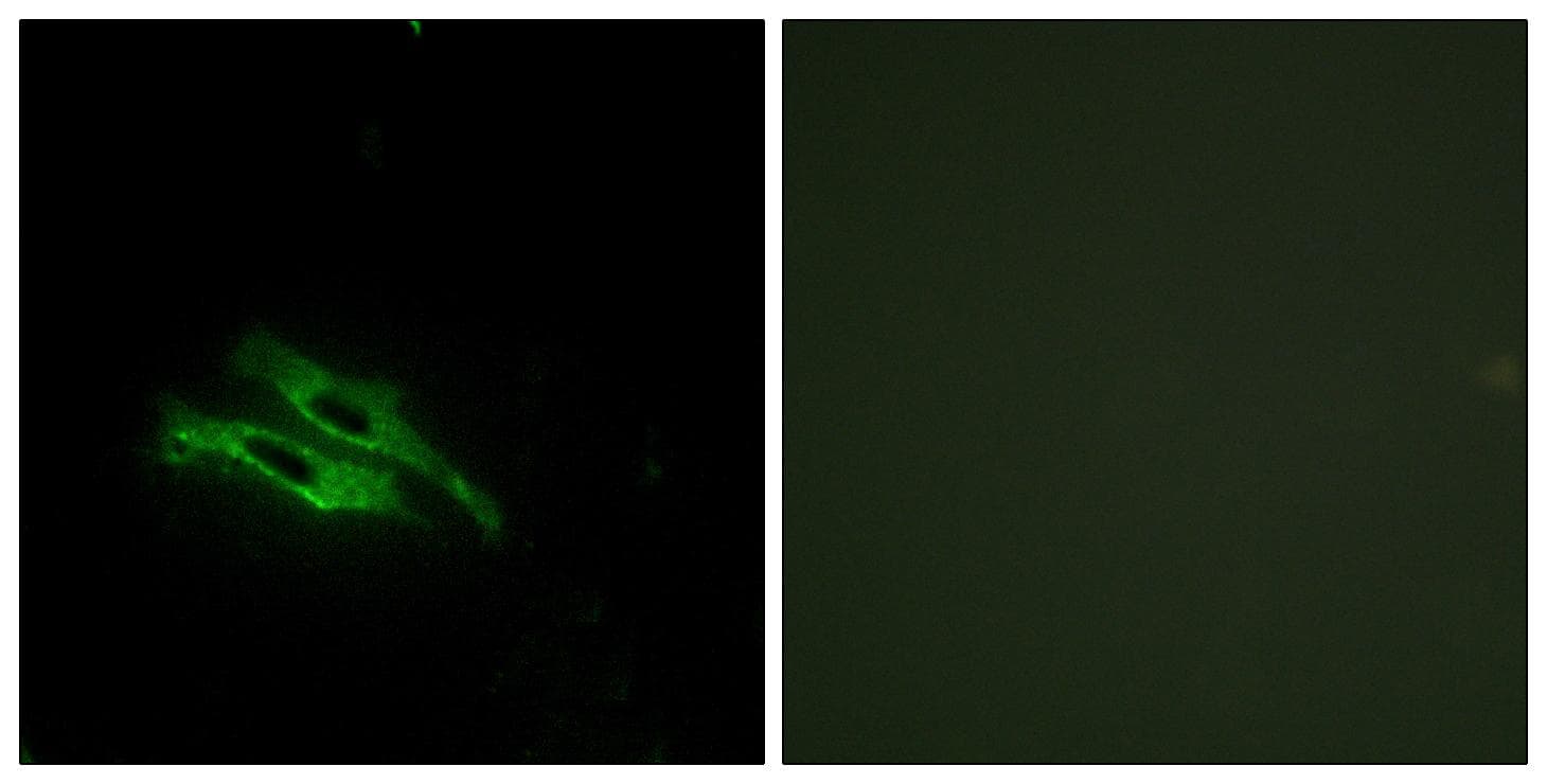 F2 / Prothrombin / Thrombin Antibody