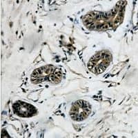 Monoclonal Mouse anti-Human TUBB3 / Tubulin Beta 3 Antibody (IHC, IF, WB)