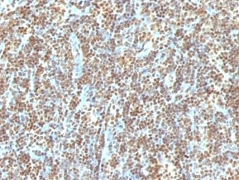 DNA ds Antibody (clone 121-3)