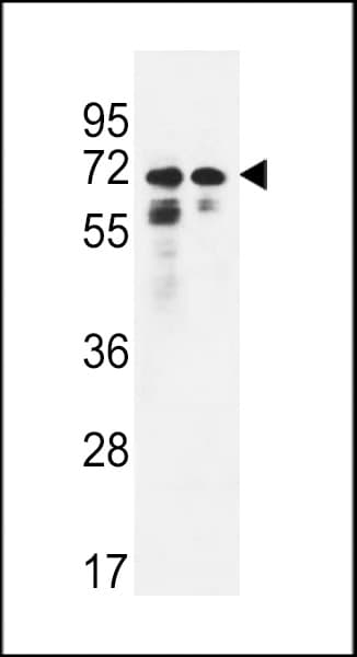 PNPLA8 Antibody (aa212-240)