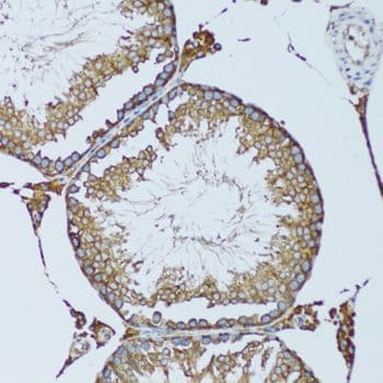 RPN1 / Ribophorin I Antibody