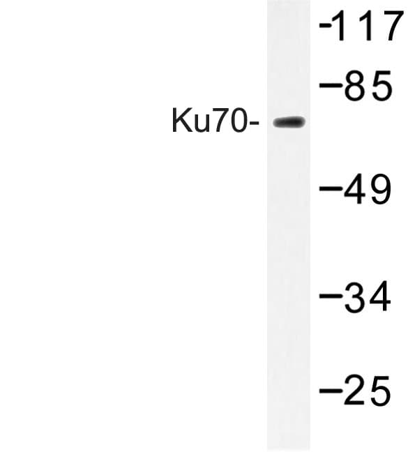 XRCC6 / Ku70 Antibody (Ser1)