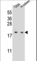 Polyclonal Rabbit anti-Human LSM7 Antibody (aa45-72, WB)