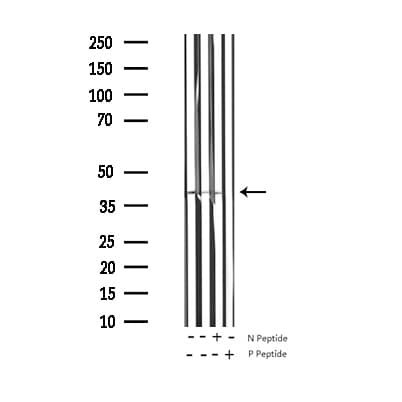 Polyclonal Rabbit anti-Human MARCKS Antibody (phospho-Ser158, WB)