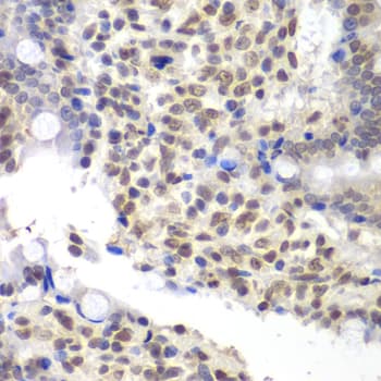 Polyclonal Rabbit anti-Human U2AF1 Antibody (IHC, WB)