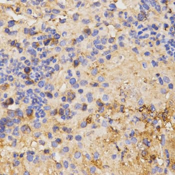 CSF2RA / CD116 Antibody