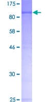 Human TRMT2A Protein (Recombinant GST)