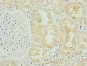 Polyclonal Rabbit anti-Human COG4 Antibody (IHC, WB)