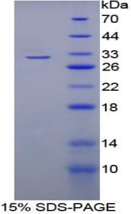 Rat RBFOX1 / A2BP1 Protein (Recombinant His-T7)