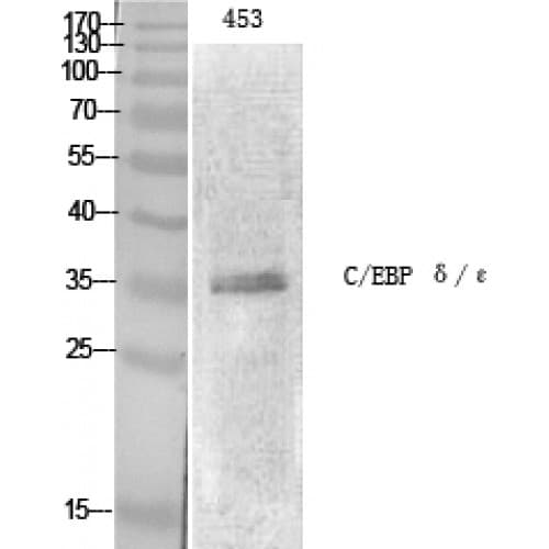 Polyclonal Rabbit anti-Human C/EBP Epsilon / CEBPE Antibody (10-90 aa, IHC, IF, WB)